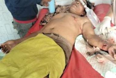 Duel Maut di Sawah Rejang Lebong: Petani Luka Parah Digigit Babi Hutan